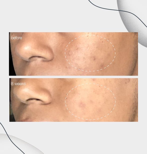 Dermalogica®powerbright dark spot serum 30ml