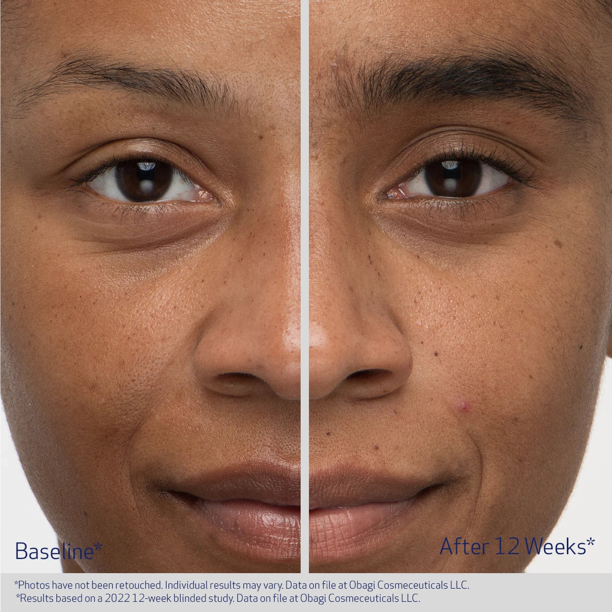 Obagi NU-CIL Eyebrow Boosting Serum 5ml – before and after 1
