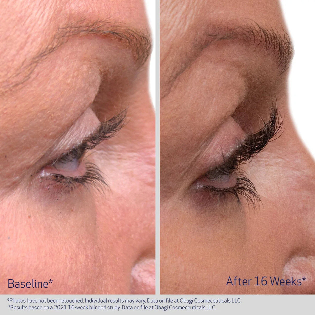 Obagi NU-CIL Lash Duo Kit (2 x 3ml) – before and after 1