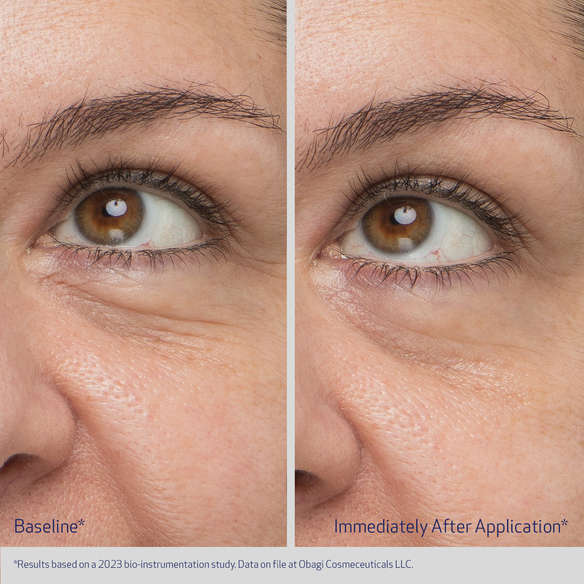 Obagi Daily Hydro-Drops® Rejuvenating Eye Gel Cream 15ml – before and after 2
