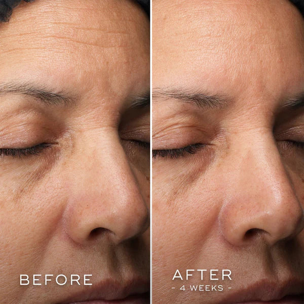 Medik8 C Tetra Luxe 30ml