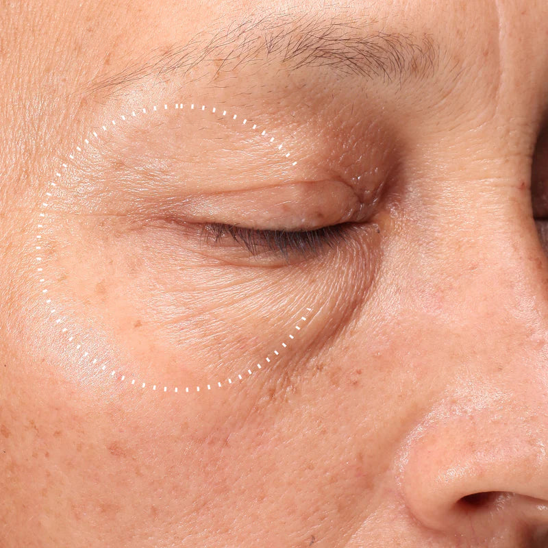 Medik8 Crystal Retinal Ceramide Eye 10 15ml