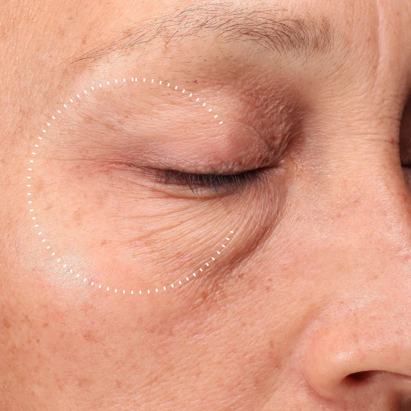 Medik8 Crystal Retinal Ceramide Eye 10 15ml