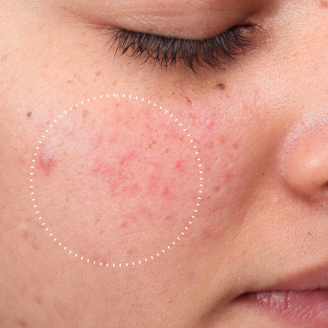 Medik8 Press & Clear 150ml