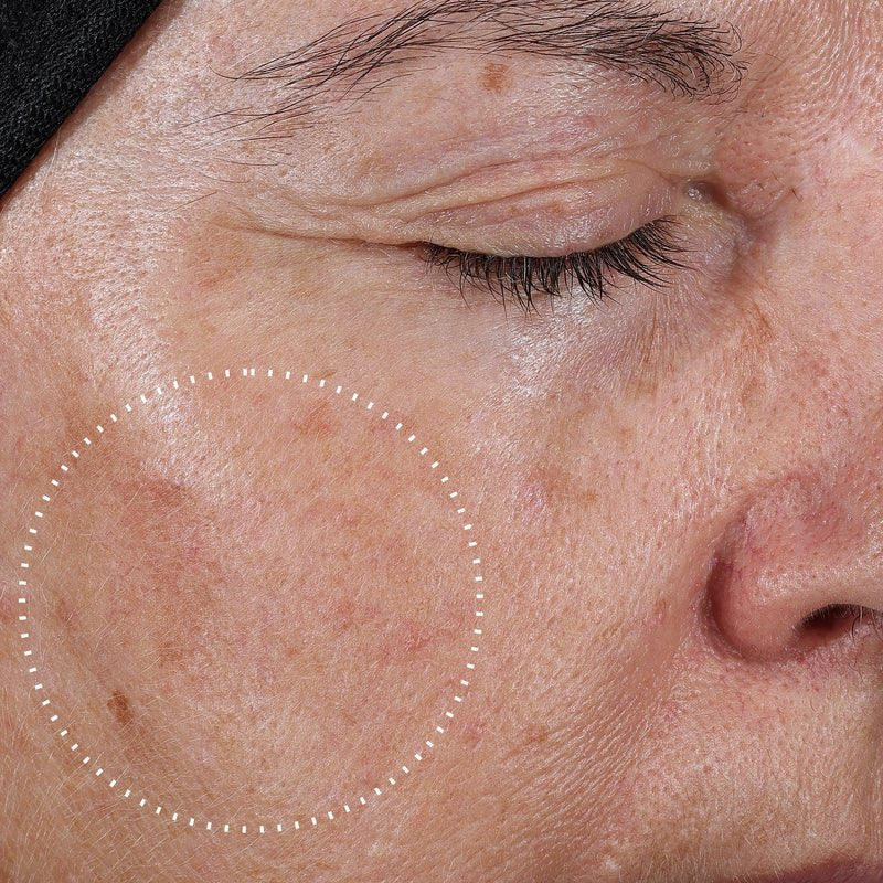 Medik8 Super C Ferulic 30ml