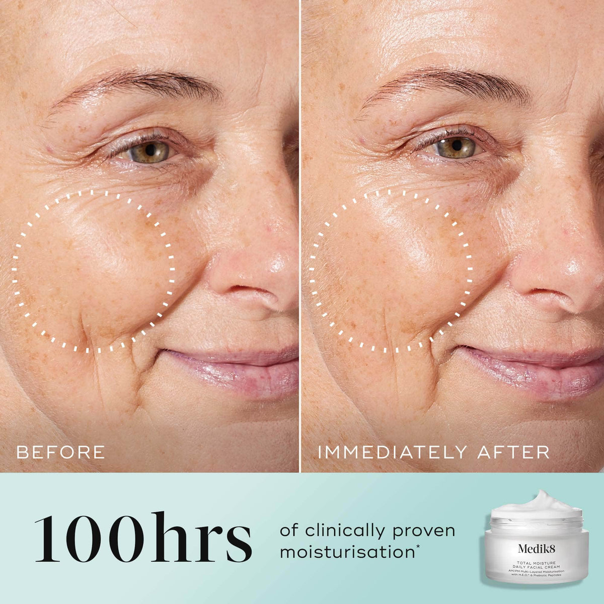 Medik8 Total Moisture Daily Facial Cream Refill