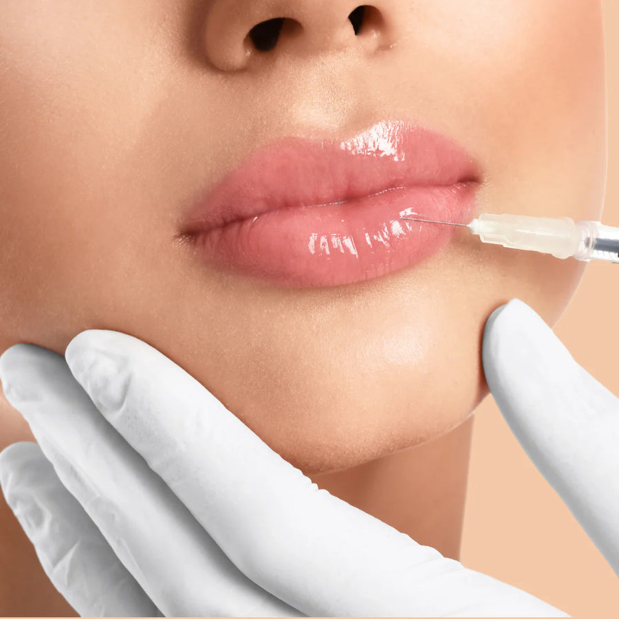 Lip Enhancement and Rehydration at SkinVitál Clinic