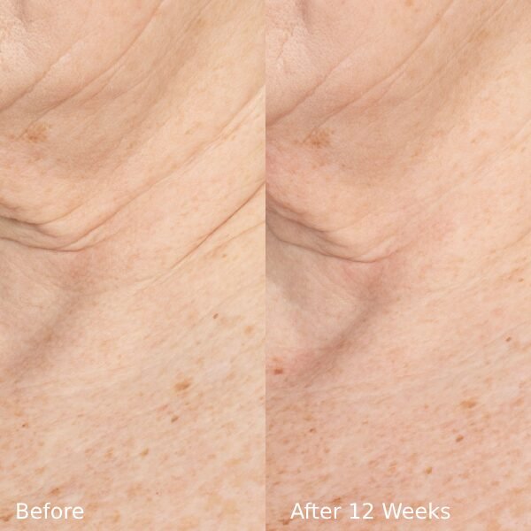 ELASTIderm Neck and Decollete Concentrate (60ml)