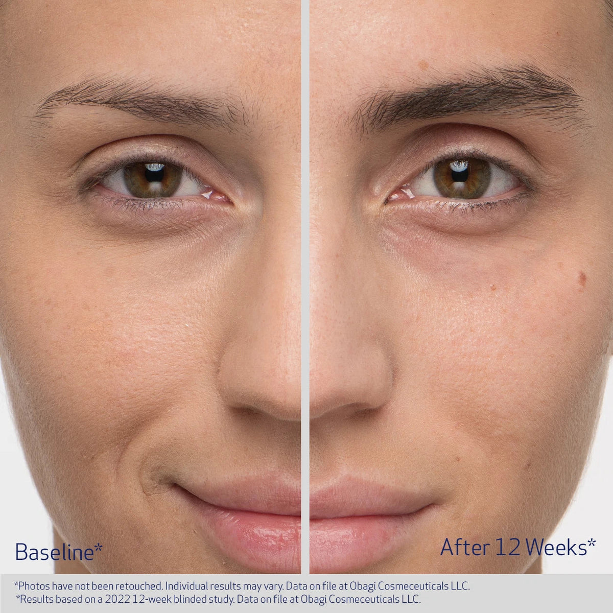 Obagi NU-CIL Eyebrow Boosting Serum 5ml – before and after 2