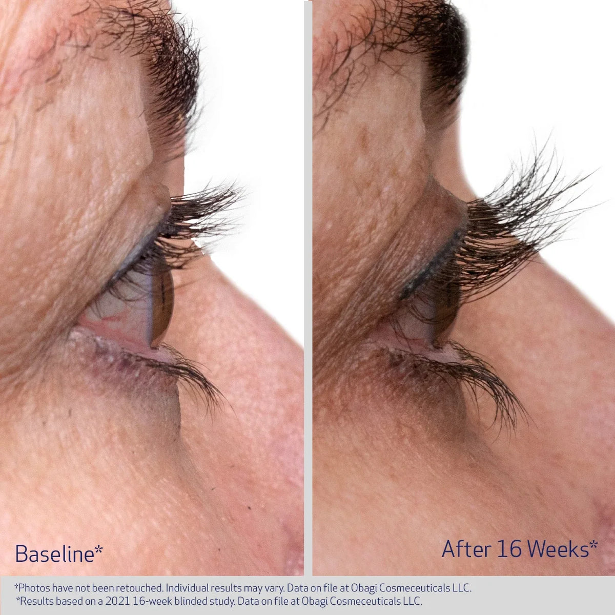 Obagi NU-CIL Eyelash Enhancing Serum 3ml – before and after 2