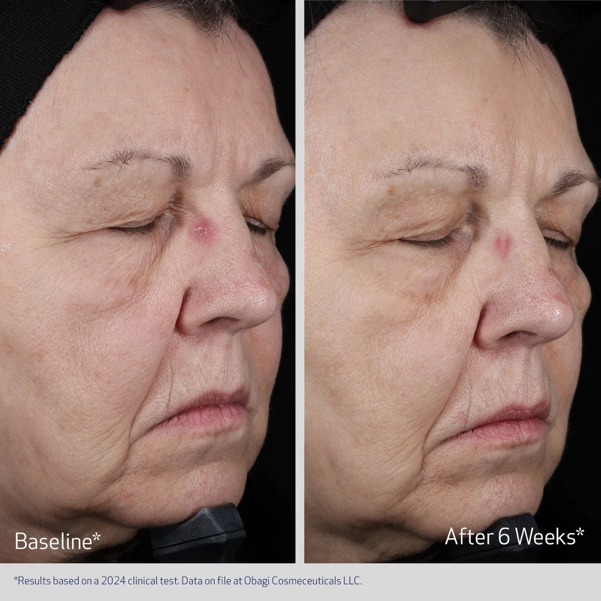 Obagi ELASTIderm® Lift Up & Sculpt Facial Moisturiser 50ml – before and after 2
