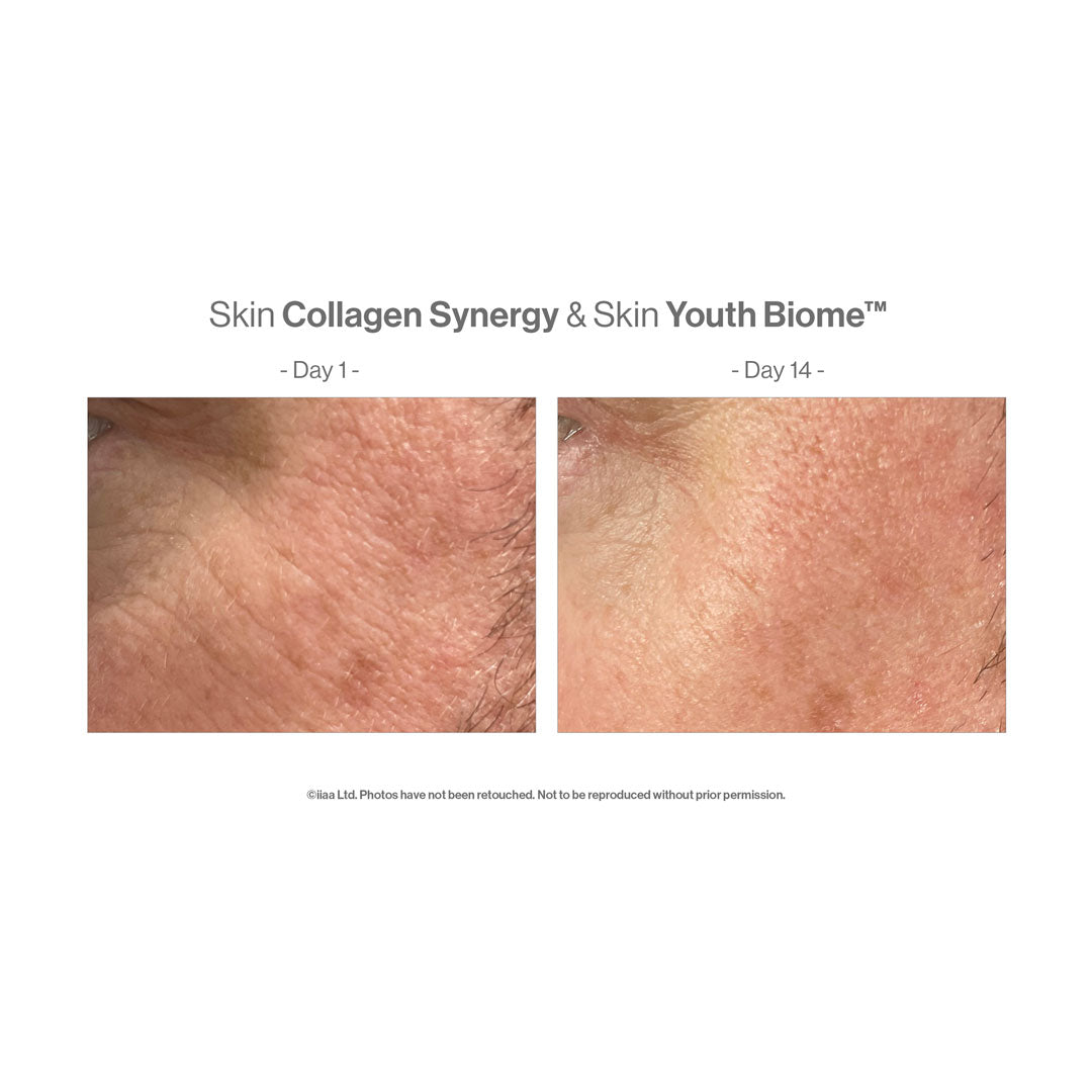 Advanced Nutrition Programme™ Skin Collagen Synergy – before and after (unretouched)