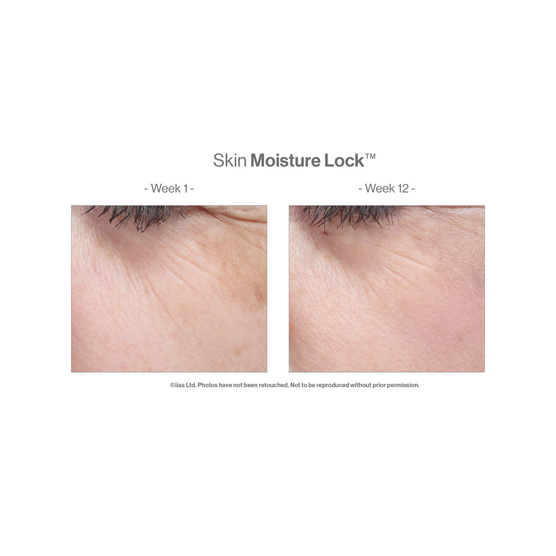 Advanced Nutrition Programme™ Skin Moisture Lock™ – before and after (unretouched)