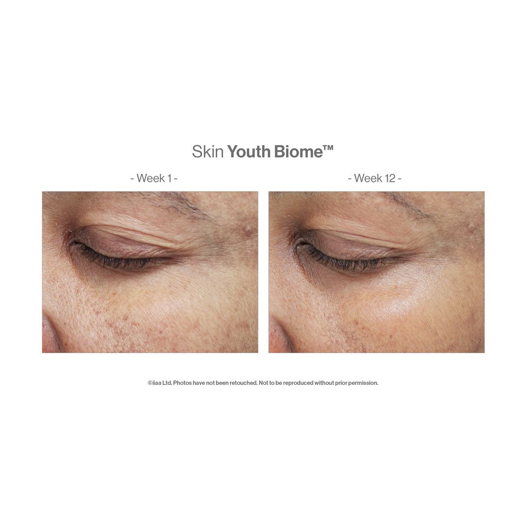 Advanced Nutrition Programme™ Skin Youth Biome™ – before and after (unretouched)