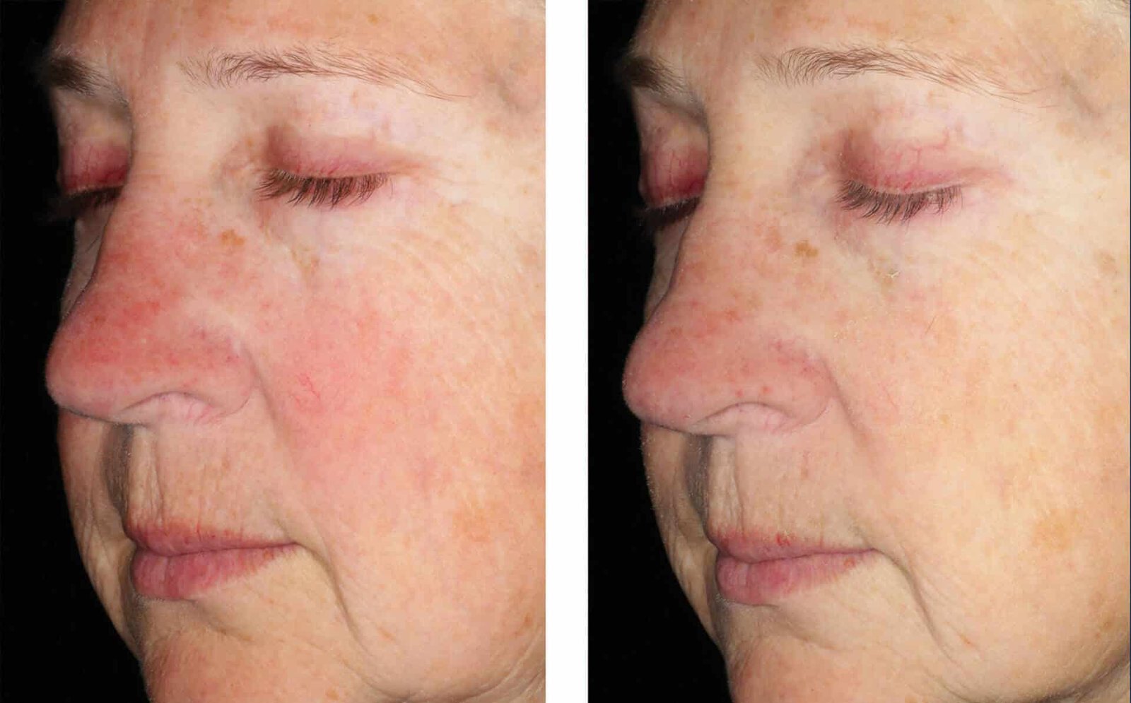 Alto Defense Serum™ FACE, 30ml