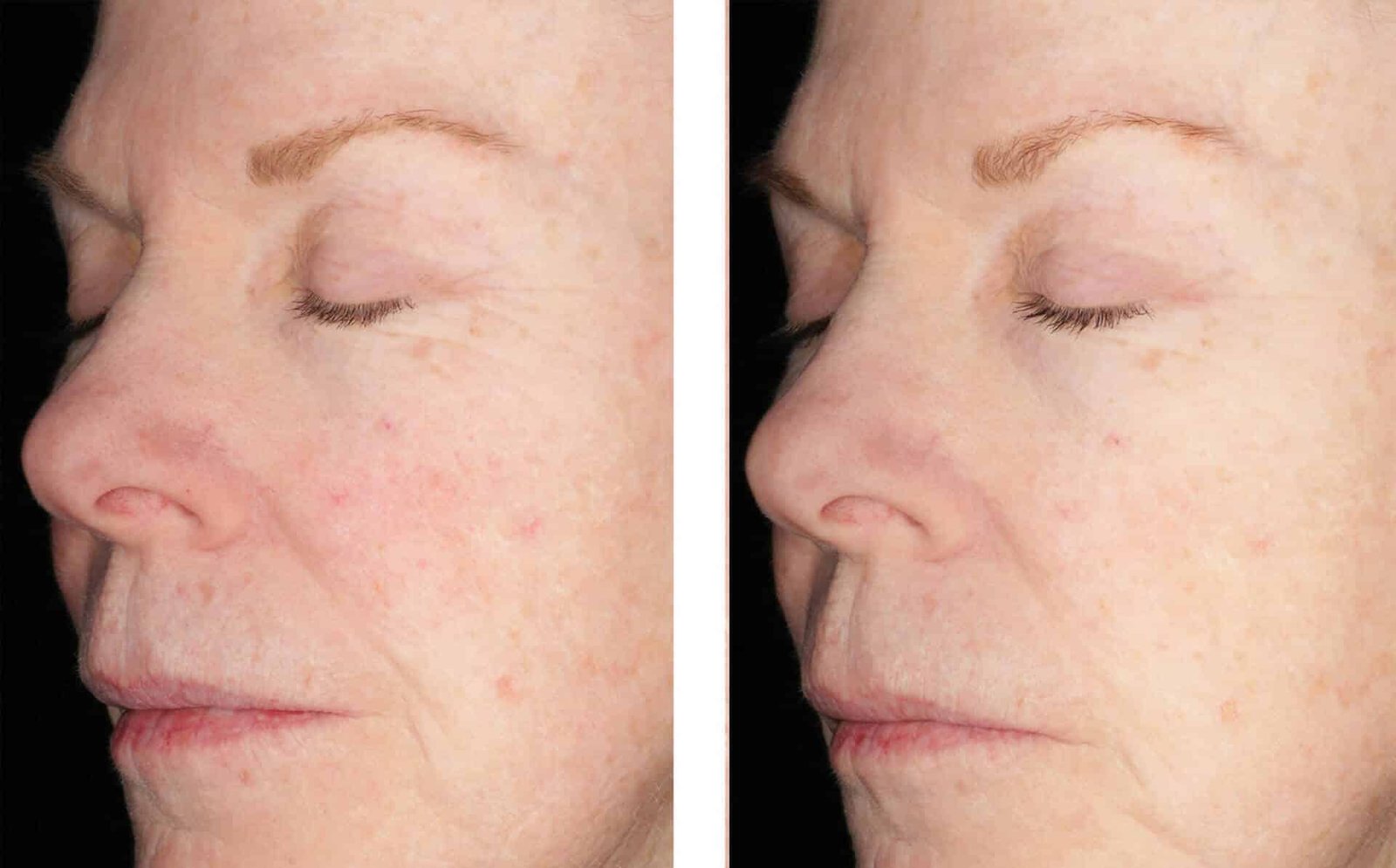 Alto Defense Serum™ FACE, 30ml