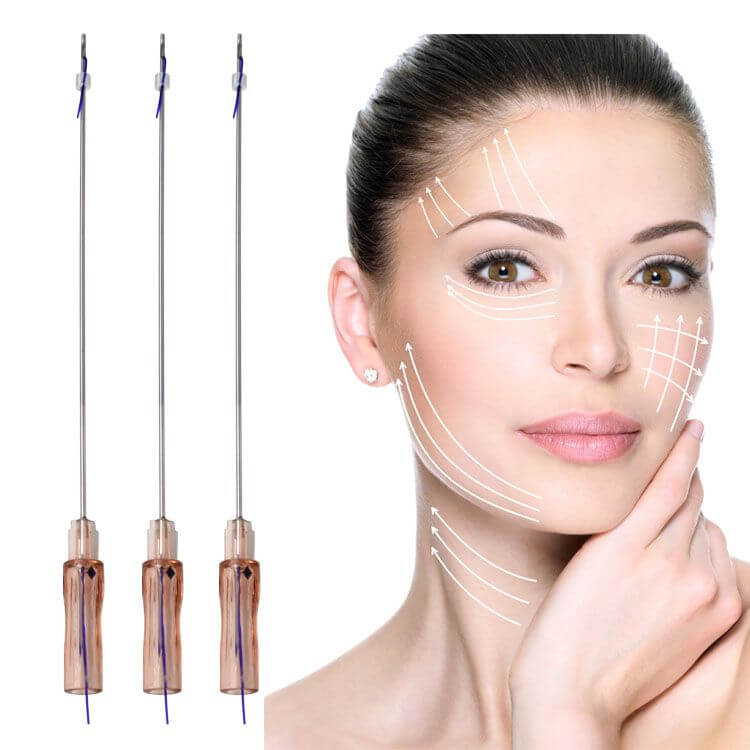 Thread Lift Treatment at SkinVitál Clinic