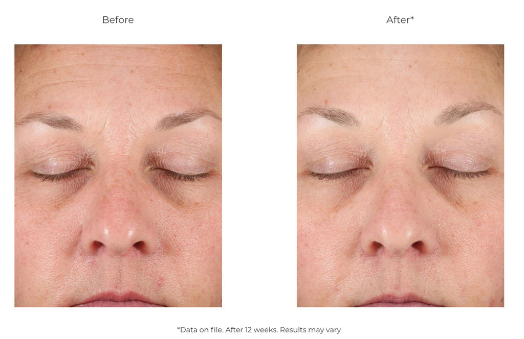 Revision D.E.J. FACE cream, 48g