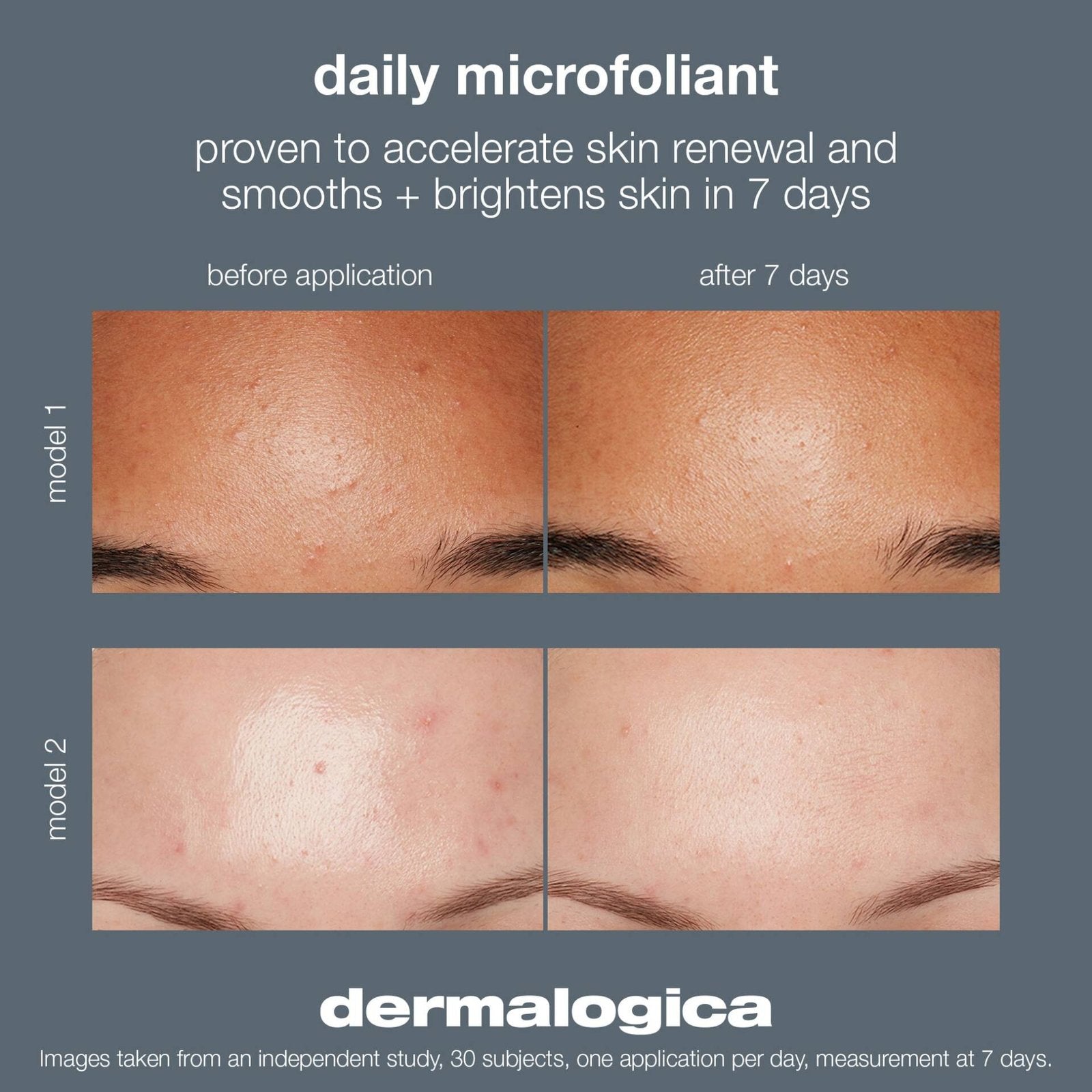 Dermalogica®daily microfoliant 74 g