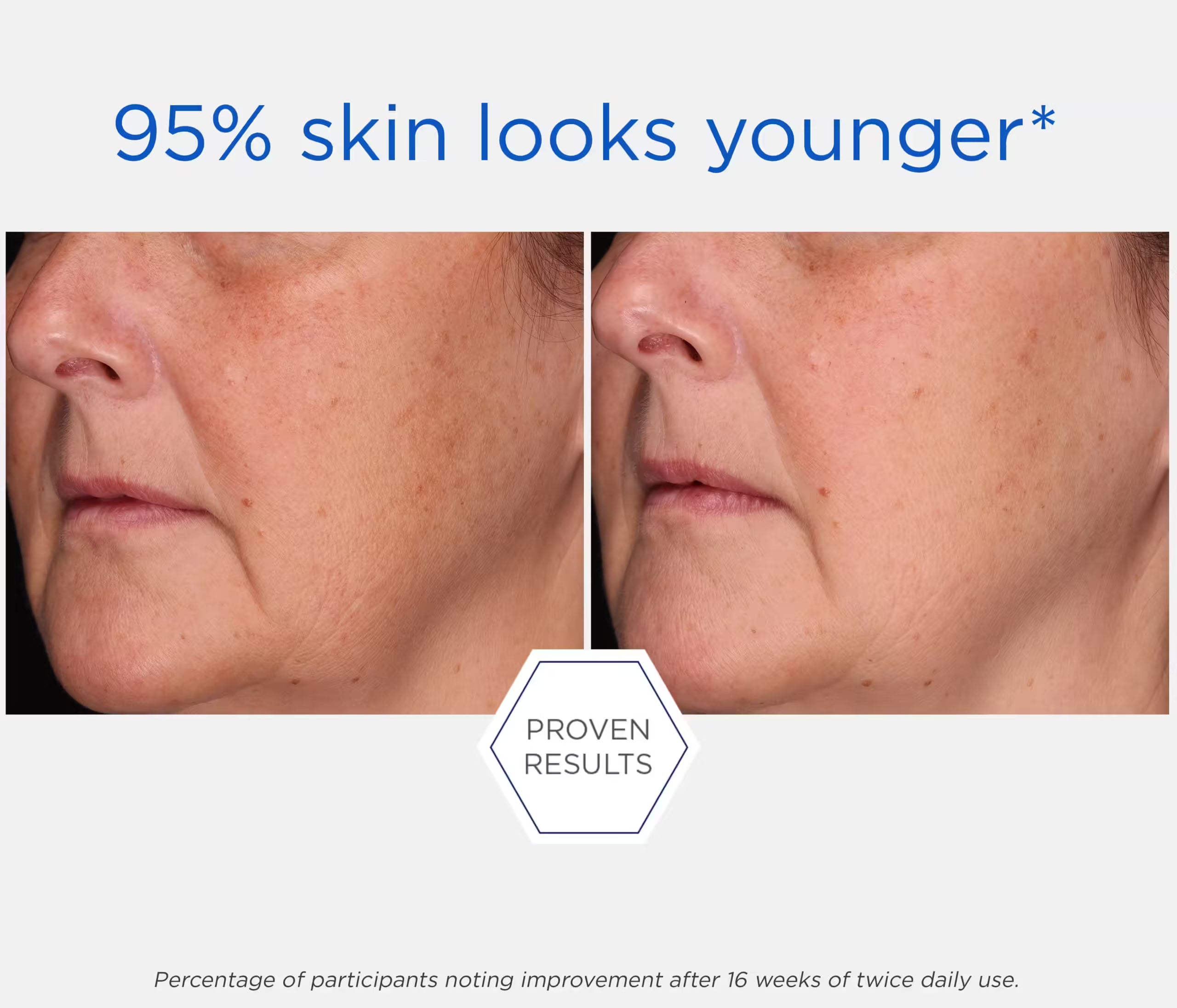 NeoStrata - Repair Rebound Sculpting Cream