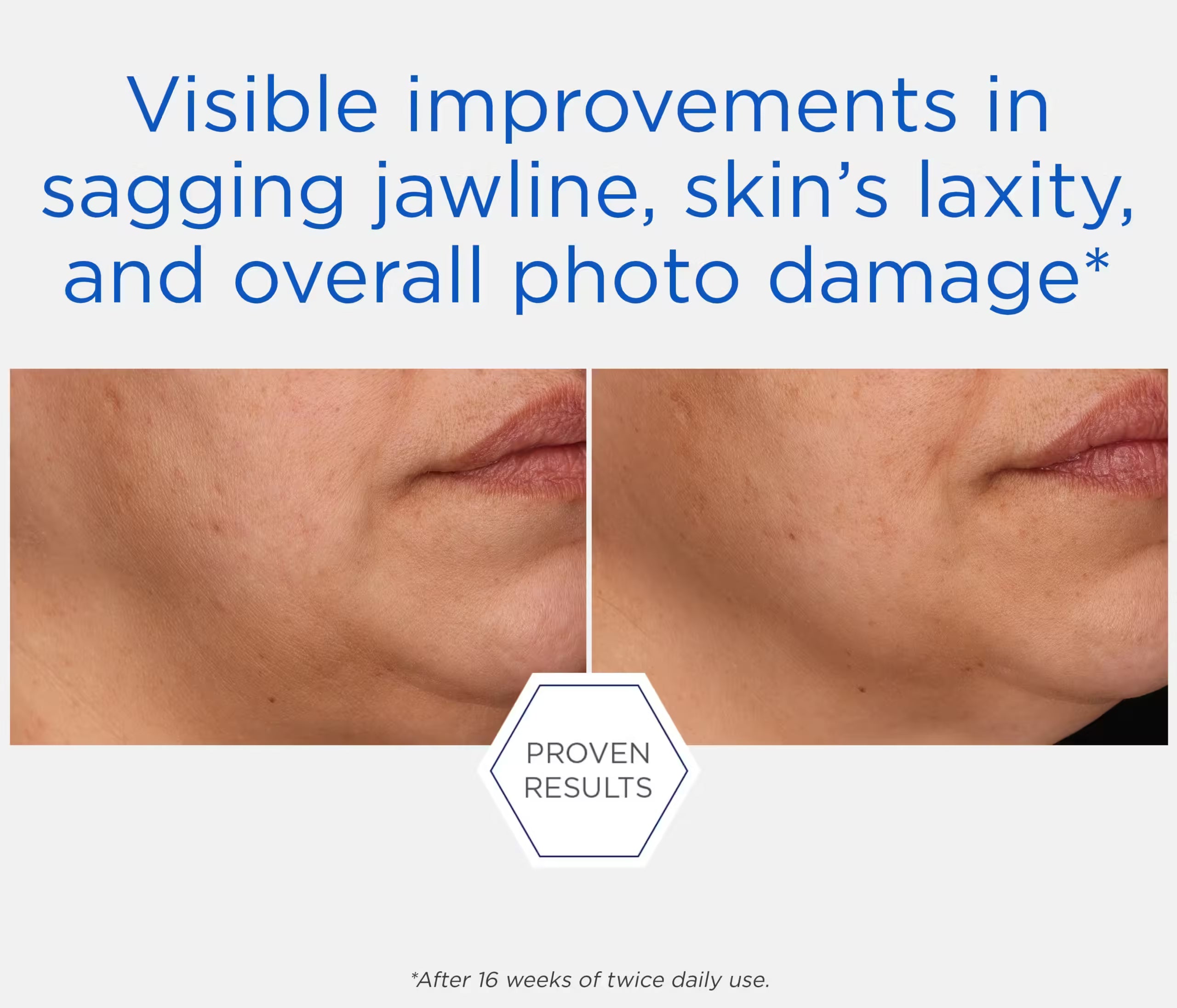 NeoStrata - Repair Rebound Sculpting Cream