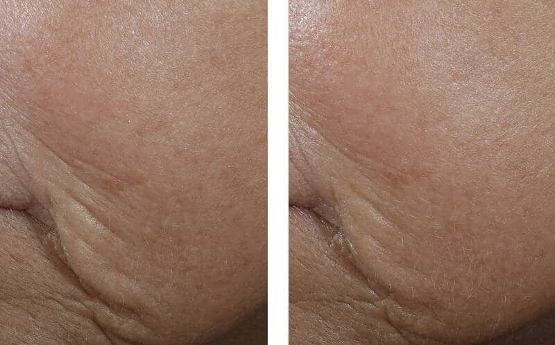 InterFuse® Treatment Cream FACE &amp; NECK, 30ml