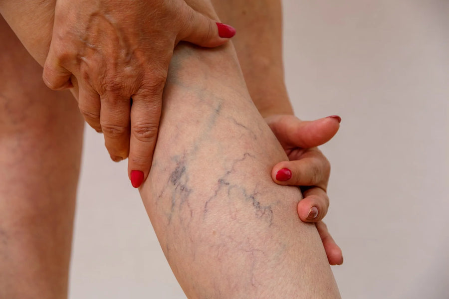 Microscerotherapy at SkinVitál Clinic
