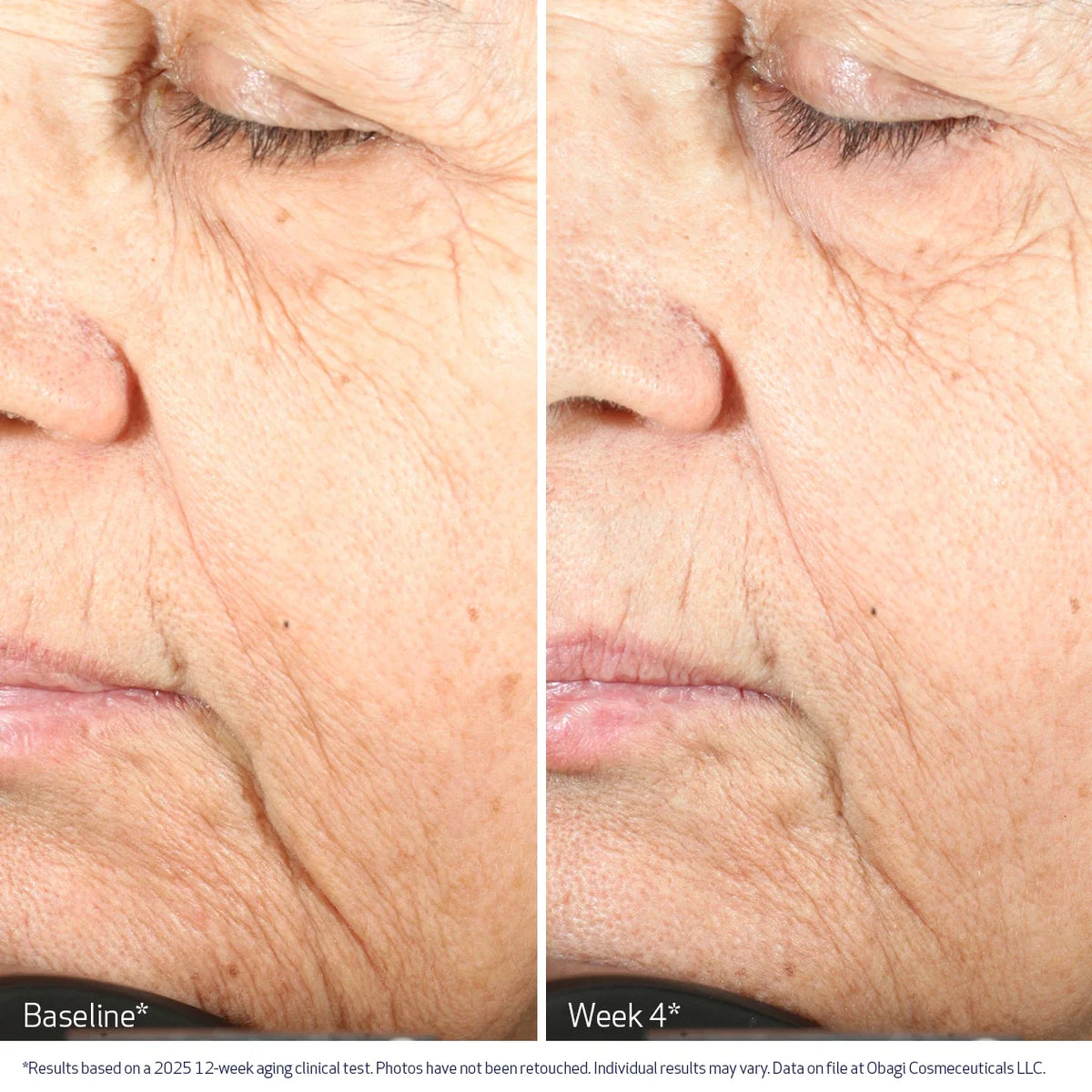Obagi NU-GEN™ Cellular Renewal Serum 30ml – before and after 2