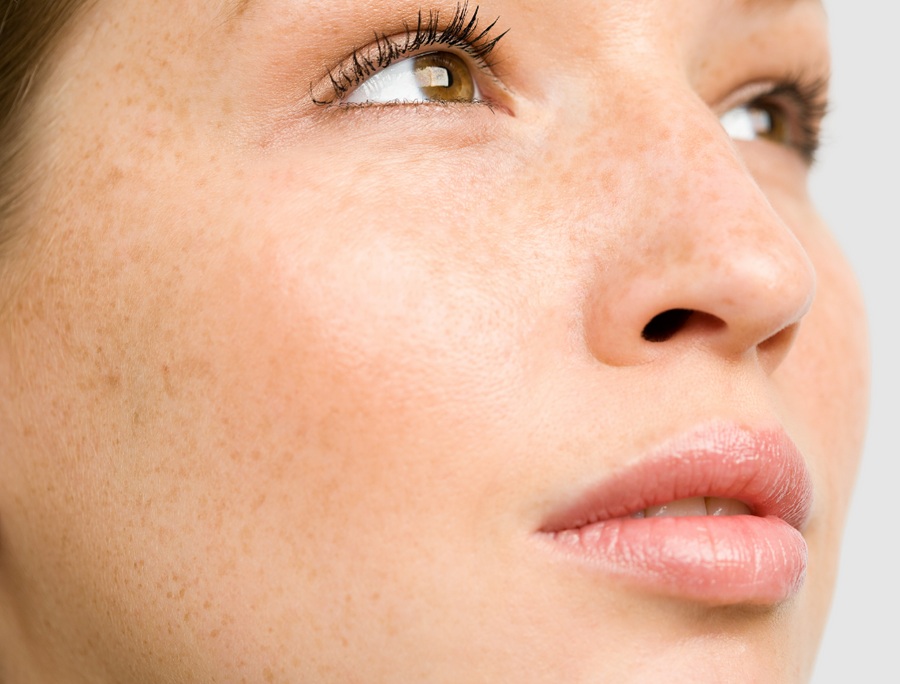 Pigmentation Treatments at SkinVitál Clinic