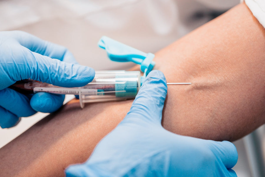 Blood Tests at SkinVitál Clinic