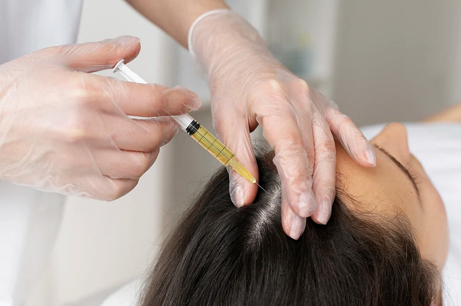 Exosome Hair Treatment at SkinVitál Clinic