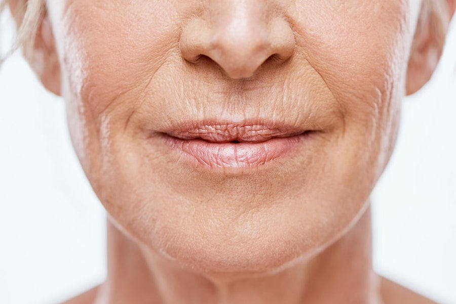 Skin Laxity Treatment at SkinVitál Clinic