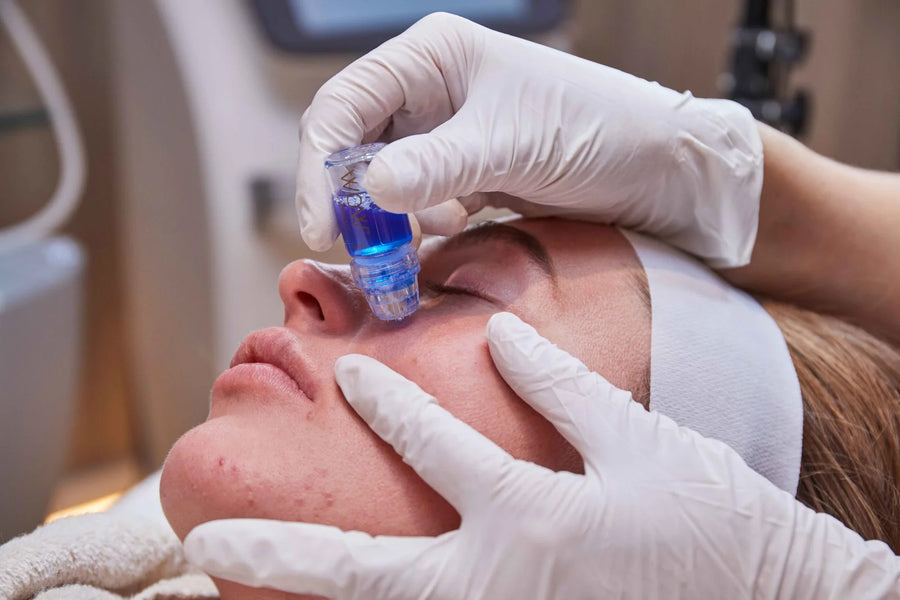 WOW Fusion Facial at SkinVitál Clinic