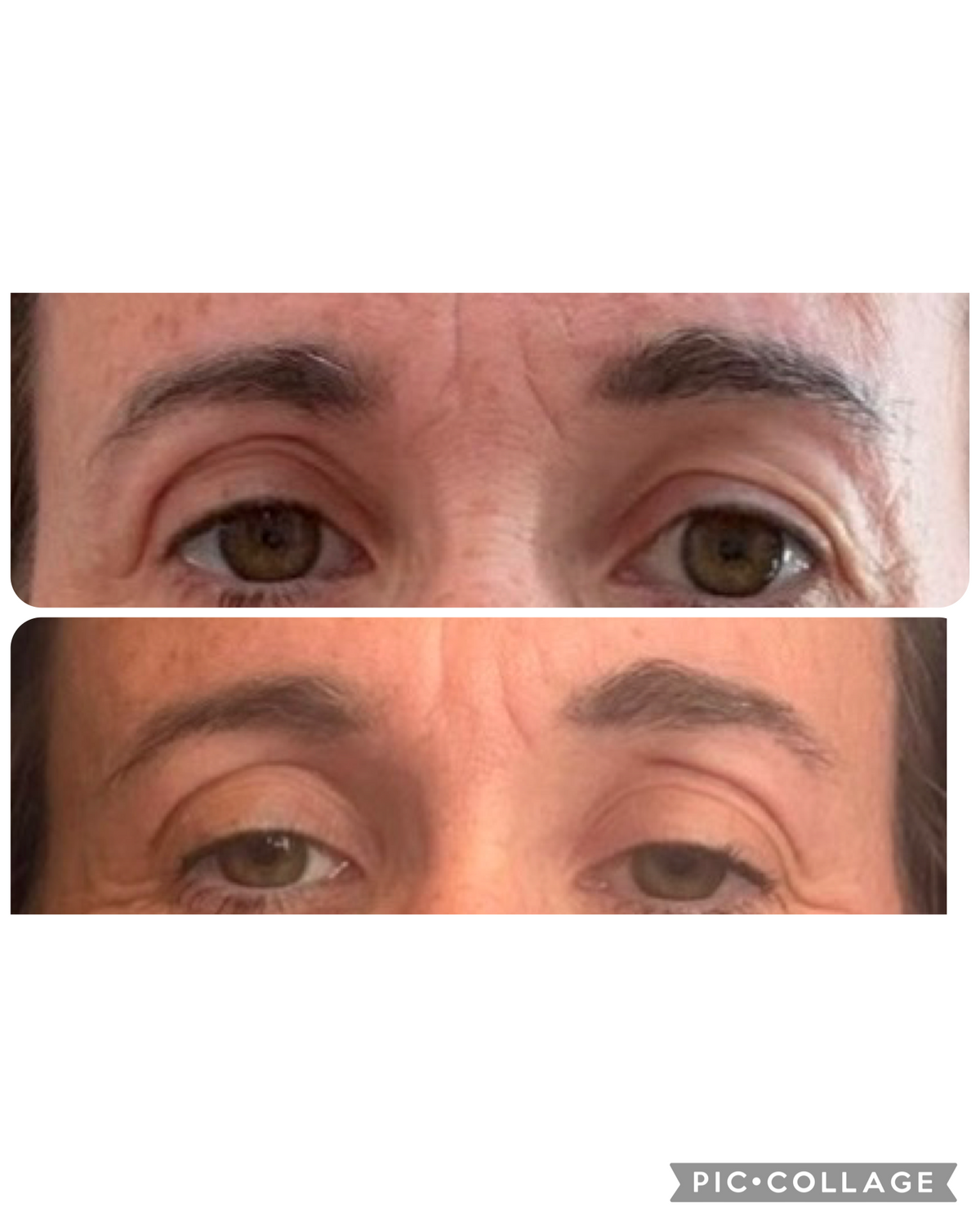 Before and after treatment at SkinVital Clinic