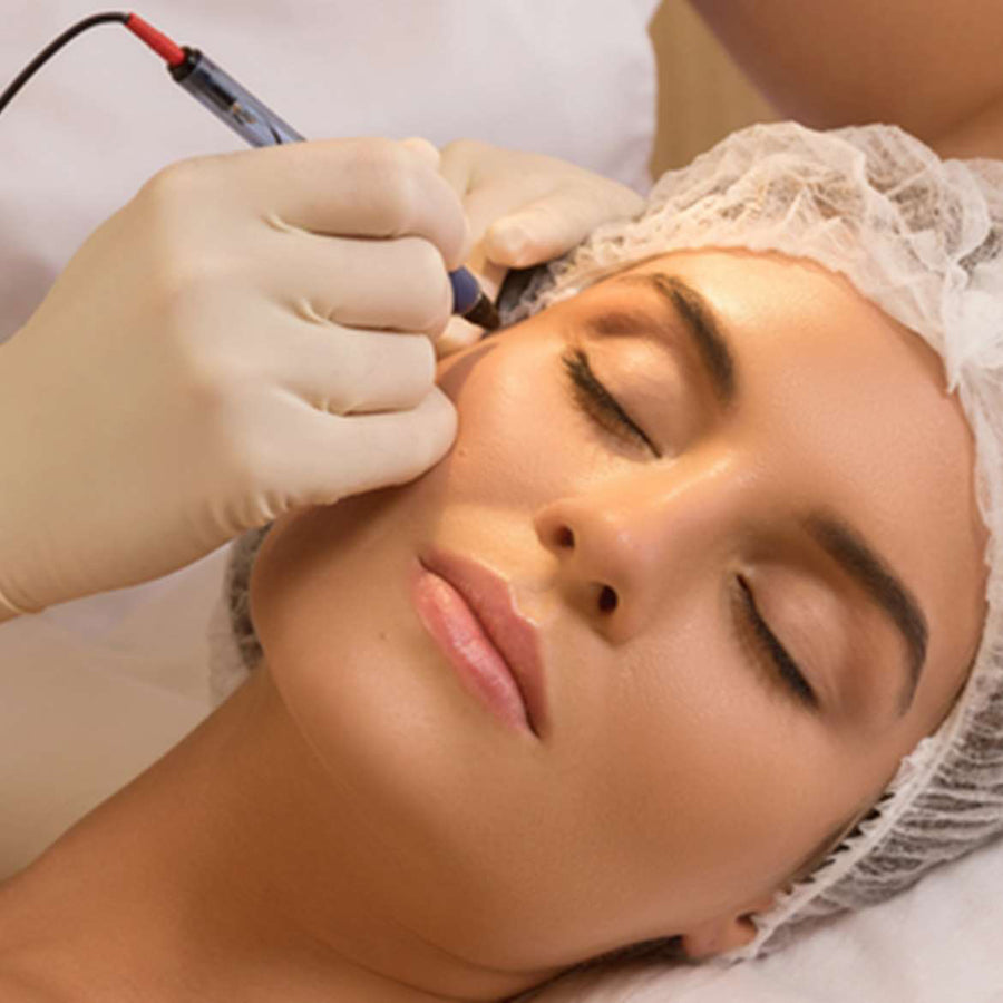 Electrolysis Treatment at SkinVitál Clinic