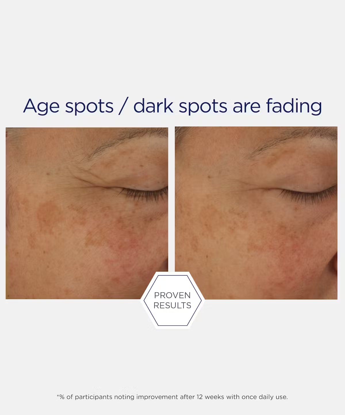 NewStrata - FIRMING Skin Active Potent Retinol Complex