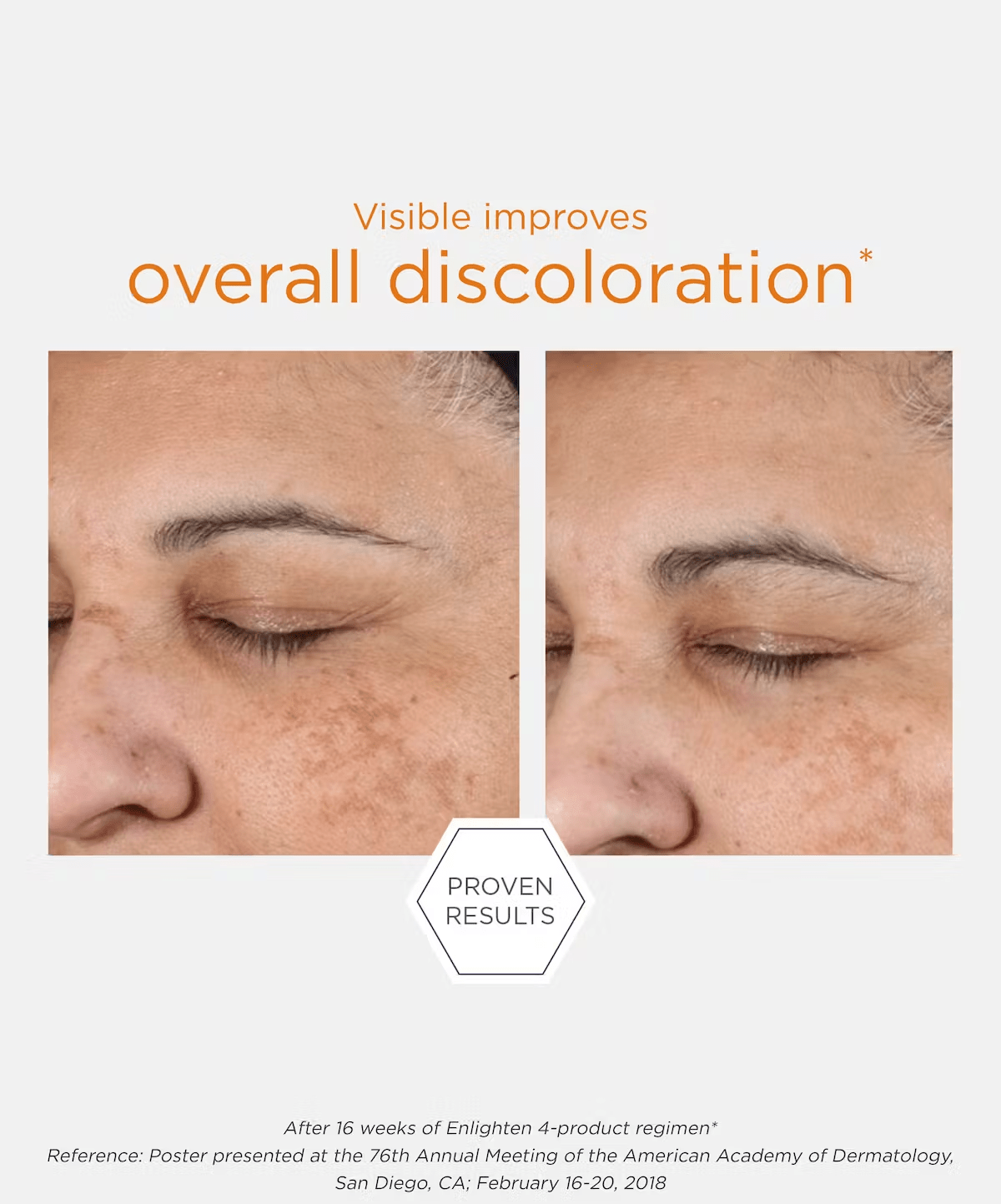 NeoStrata - ENLIGHTEN Illuminating Serum