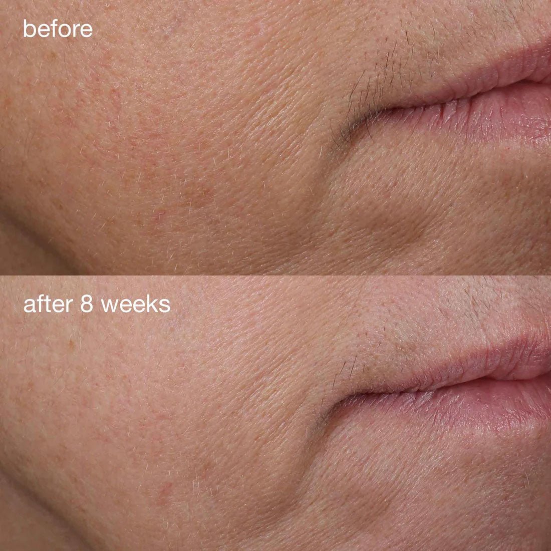 Dermalogica®phyto-nature firming serum 40 ml