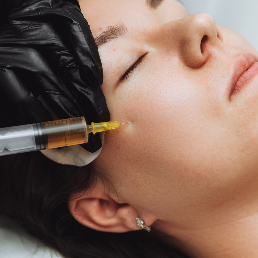 Biofiller Treatment at SkinVitál Clinic
