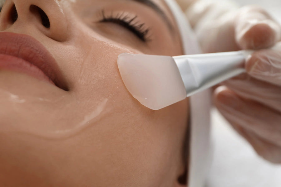 Chemical Peels at SkinVitál Clinic