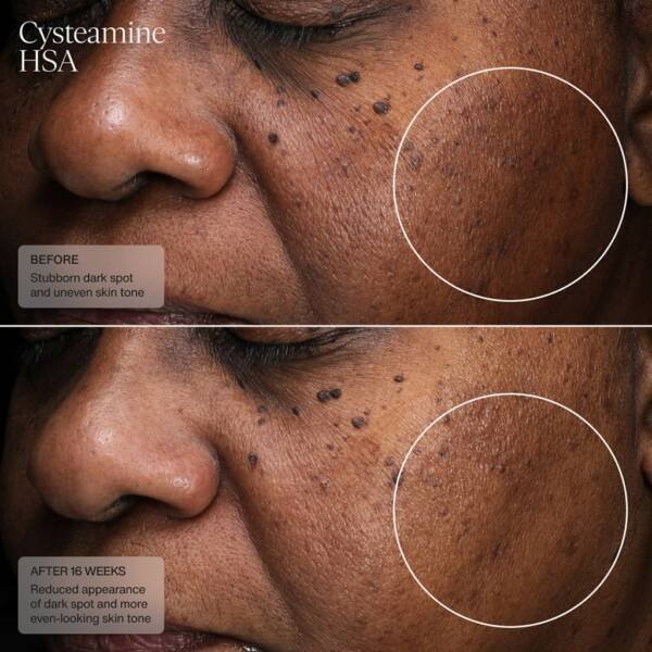 Senté Cysteamine HSA Pigment & Tone Corrector - Image 4